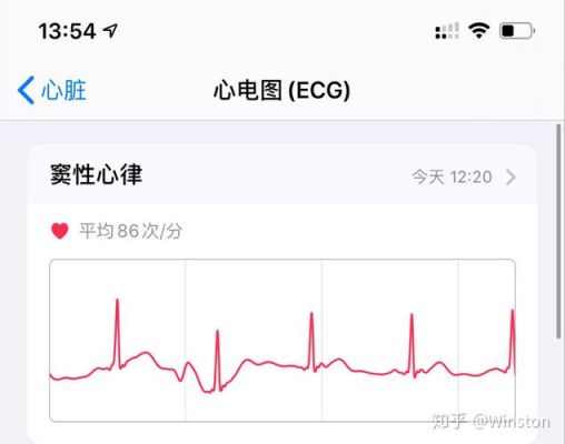 国行怎么激活ECG心电图（国内如何激活ecg）-图2