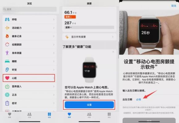 国行watch6怎么开启心电图（国行apple watch 6 如何激活心电图）-图2